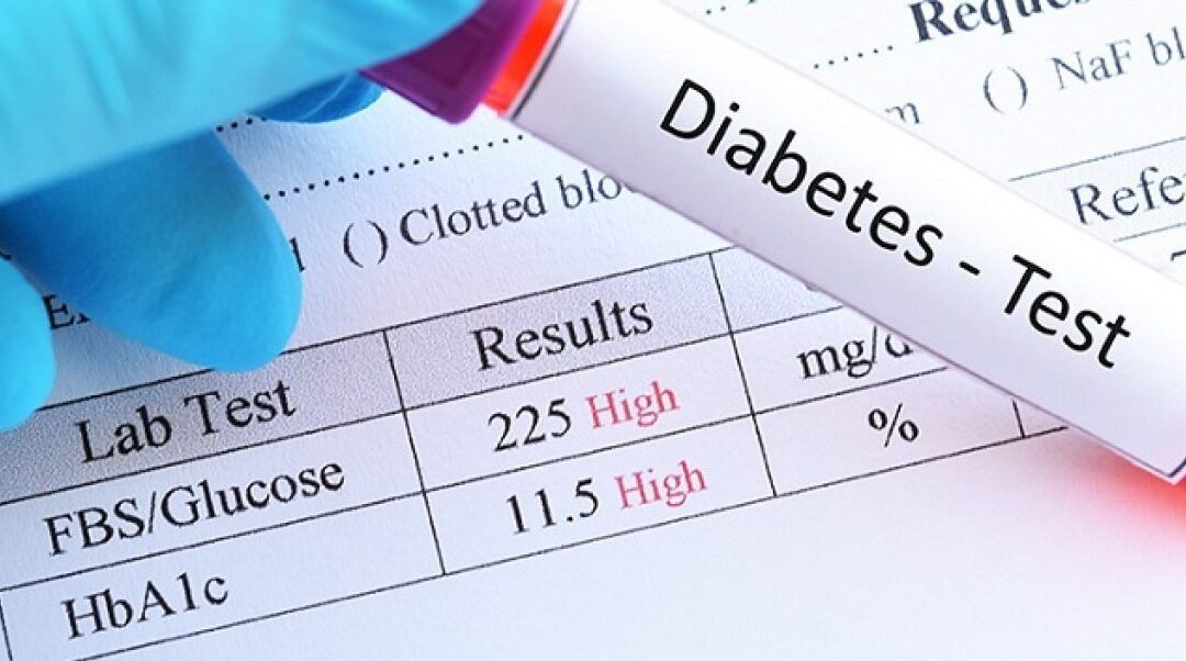 Importance of Tests for Diabetes