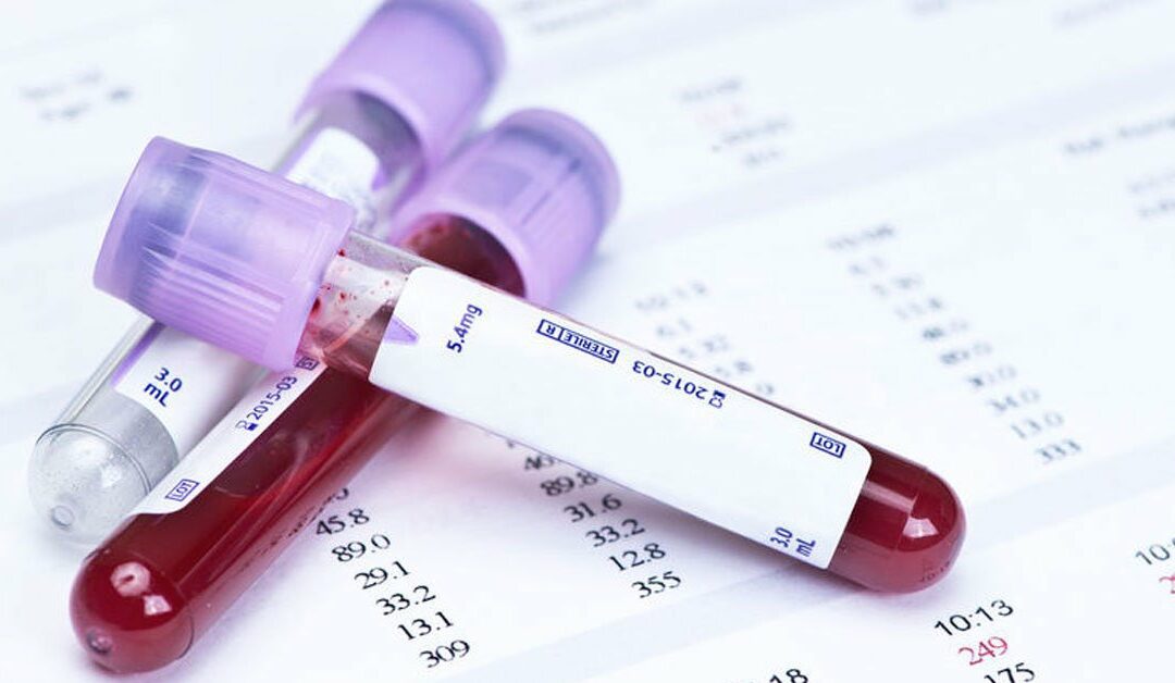 5 Blood Tests You Must Take After the Age of 30