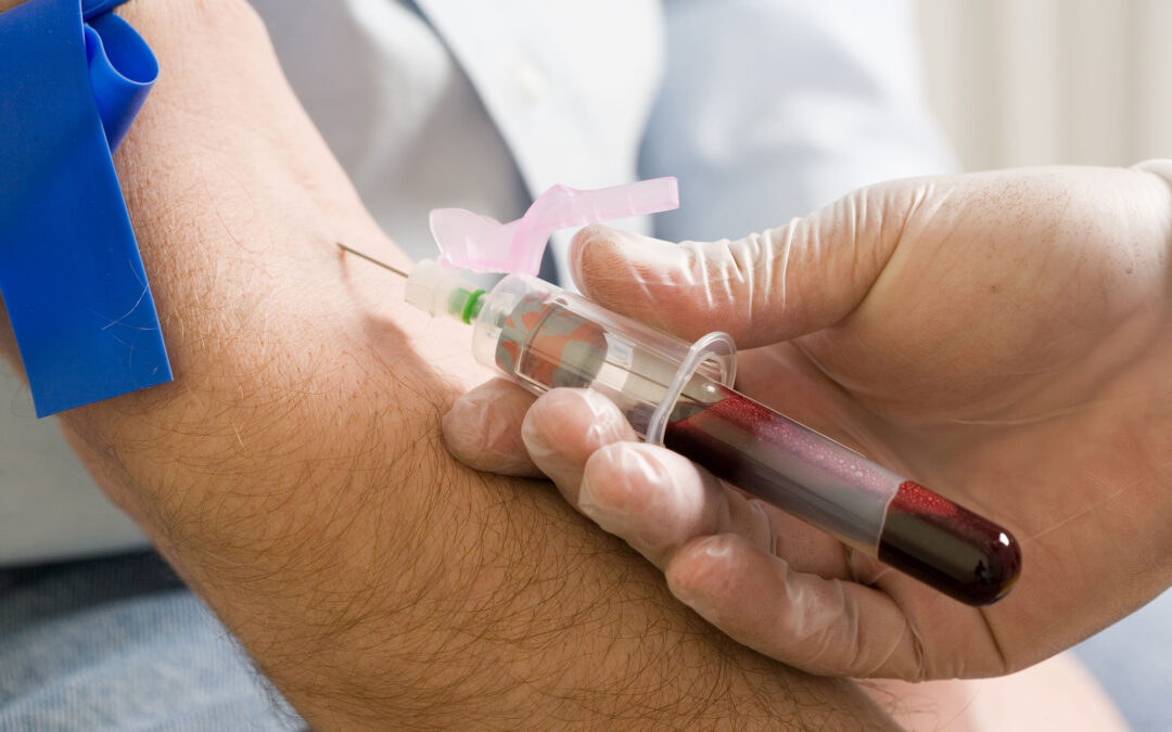 How to Detect Prostate Cancer with a Blood Test